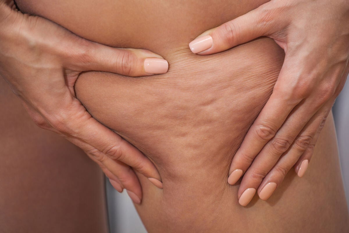 Meno ritenzione idrica e cellulite