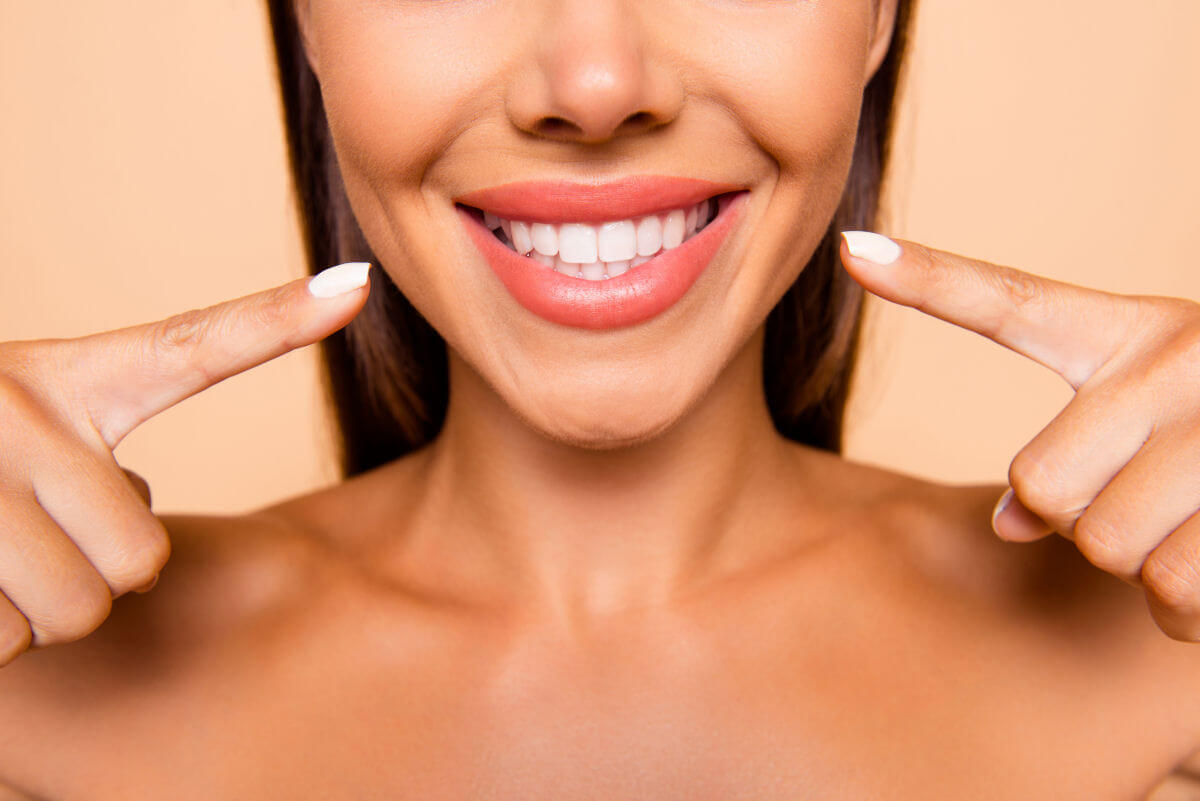 Le faccette dentali per trasformare i tuoi denti