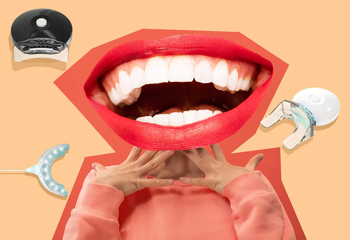 Gli 8 migliori kit per lo sbiancamento dei denti 3