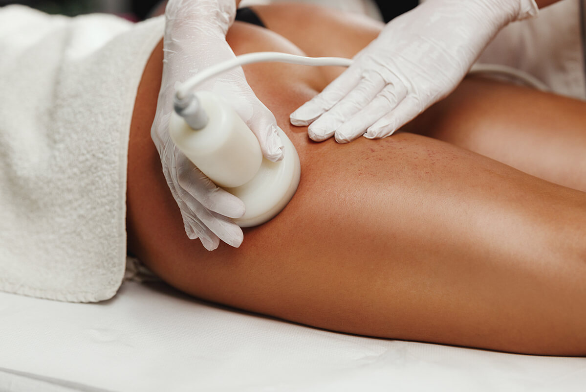 Ultrasuoni contro la cellulite