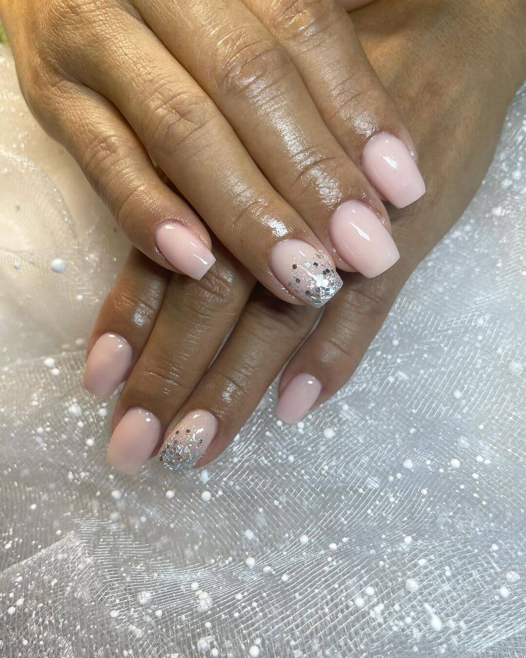 albiinails