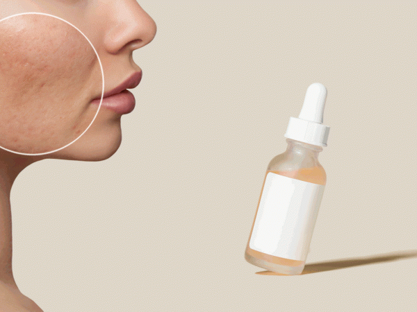 Acido-Salicilico-Cos’è,-A-Cosa-Serve-E-I-Possibili-Impieghi